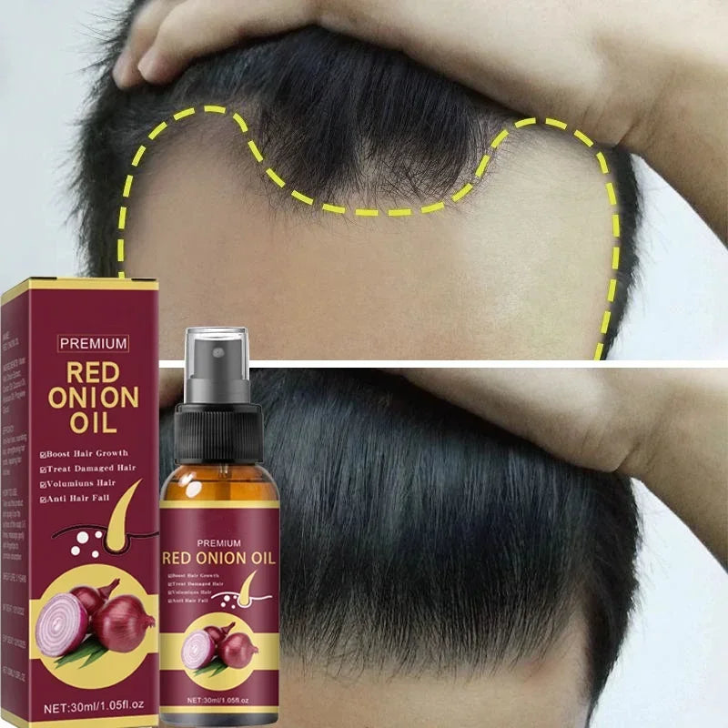 Spray Para Crescimento de Cabelo